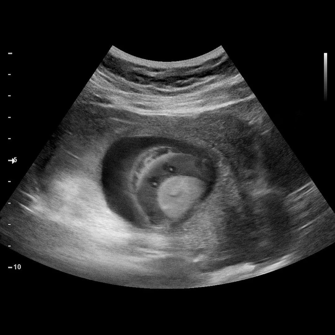 IKEA「鯊寶包」刈包